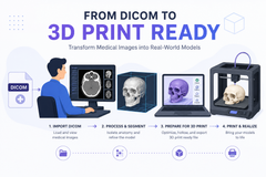 How We Convert CT Scans into Patient-Specific 3D Printed Models