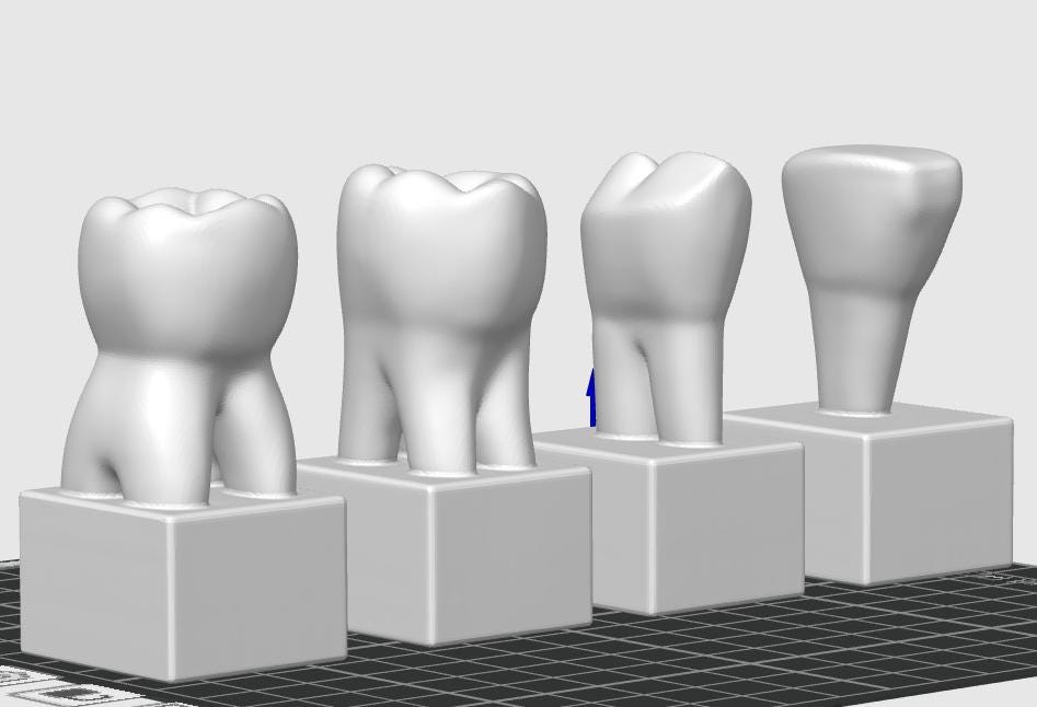 4-Piece Dental Model Set | Detailed Tooth Anatomy | Dentist Office Display | Dental School Teaching Tool