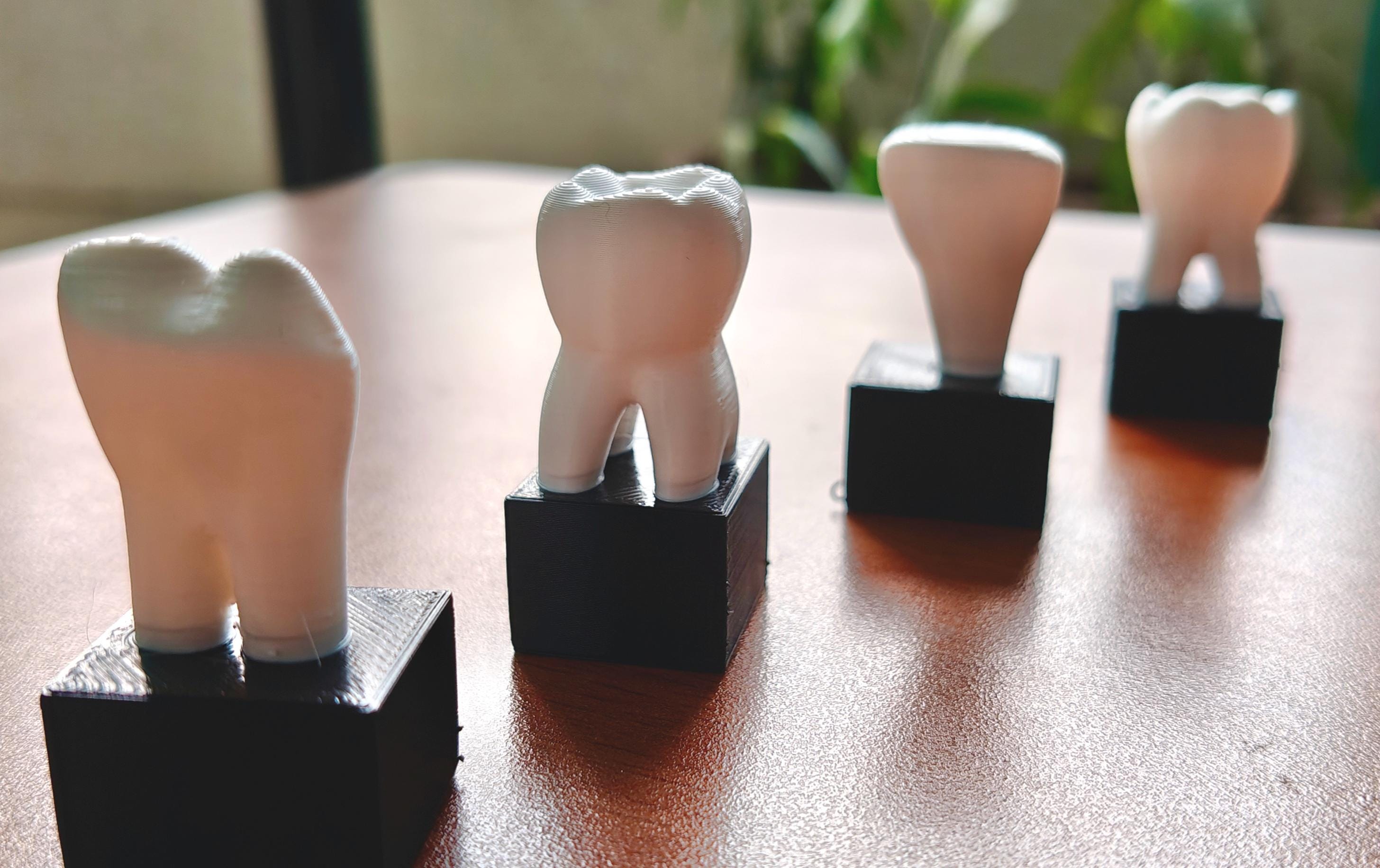 4-Piece Dental Model Set | Detailed Tooth Anatomy | Dentist Office Display | Dental School Teaching Tool