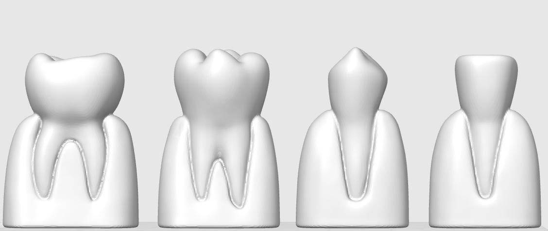 4-Piece Dental Model Set | Detailed Tooth Anatomy | Dentist Office Display | Dental School Teaching Tool