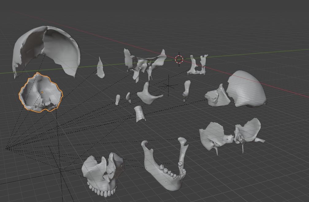 20-Part Disarticulated Human Skull Model | Medical Anatomy Study Set