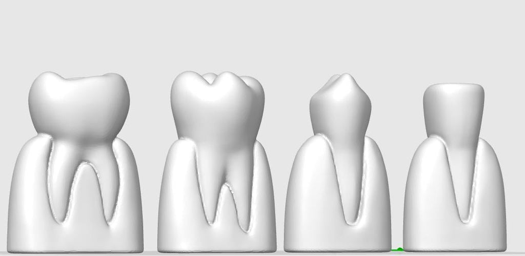 4-Piece Dental Model Set | Detailed Tooth Anatomy | Dentist Office Display | Dental School Teaching Tool