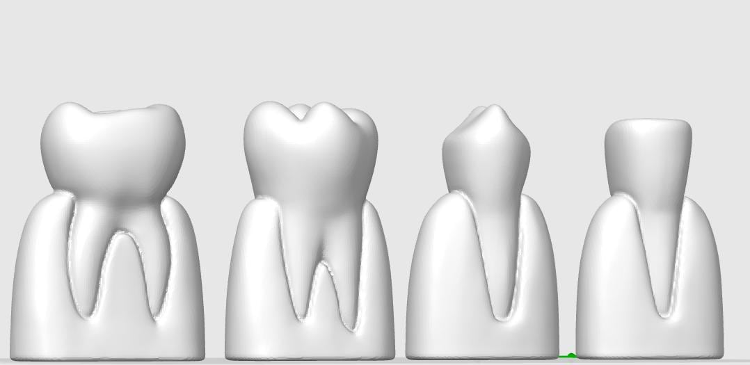 4-Piece Dental Model Set | Detailed Tooth Anatomy | Dentist Office Display | Dental School Teaching Tool