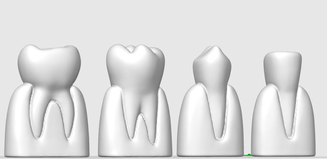 4-Piece Dental Model Set | Detailed Tooth Anatomy | Dentist Office Display | Dental School Teaching Tool