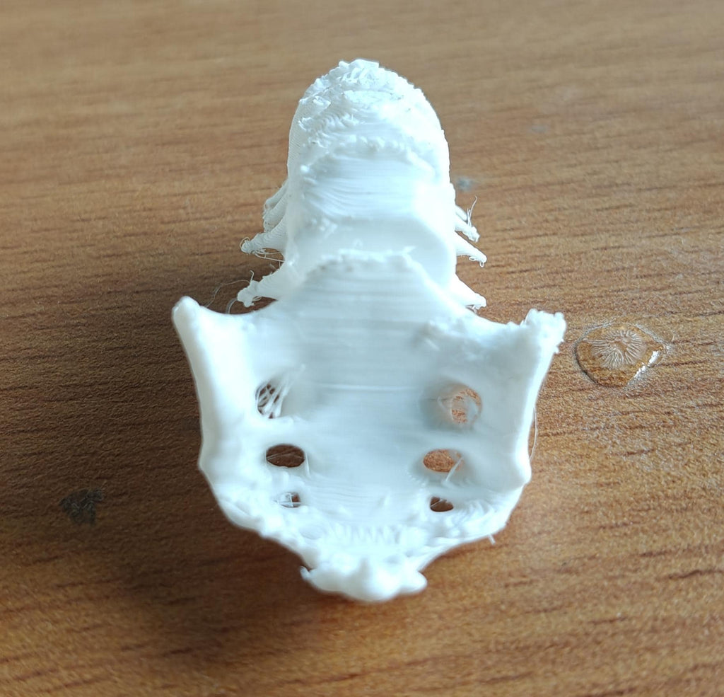 Anatomical Lumbar Spine Model L1-L5 Vertebrae with Sacrum | Medical Education Prop (170mm or 240mm)