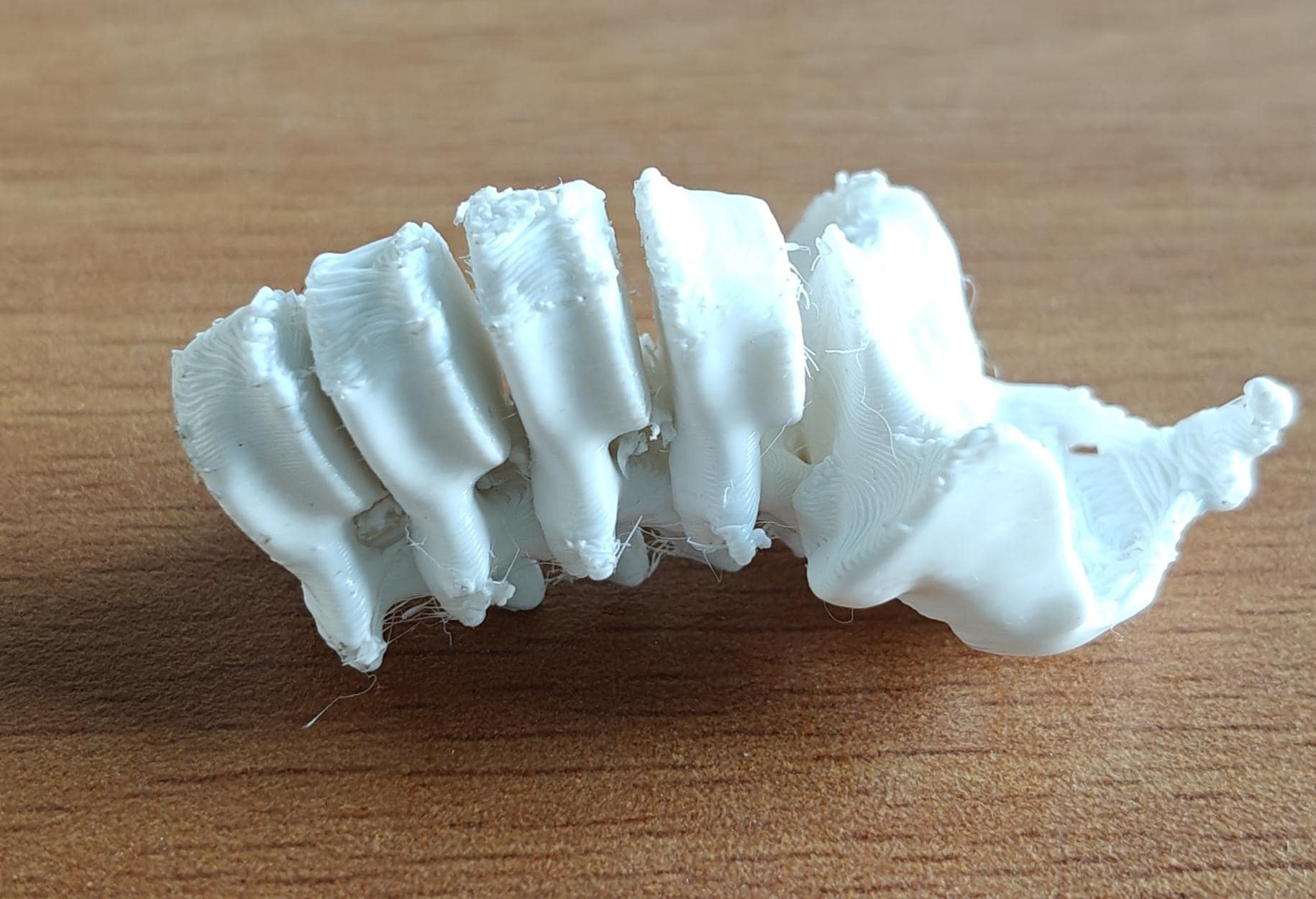 Anatomical Lumbar Spine Model L1-L5 Vertebrae with Sacrum | Medical Education Prop (170mm or 240mm)
