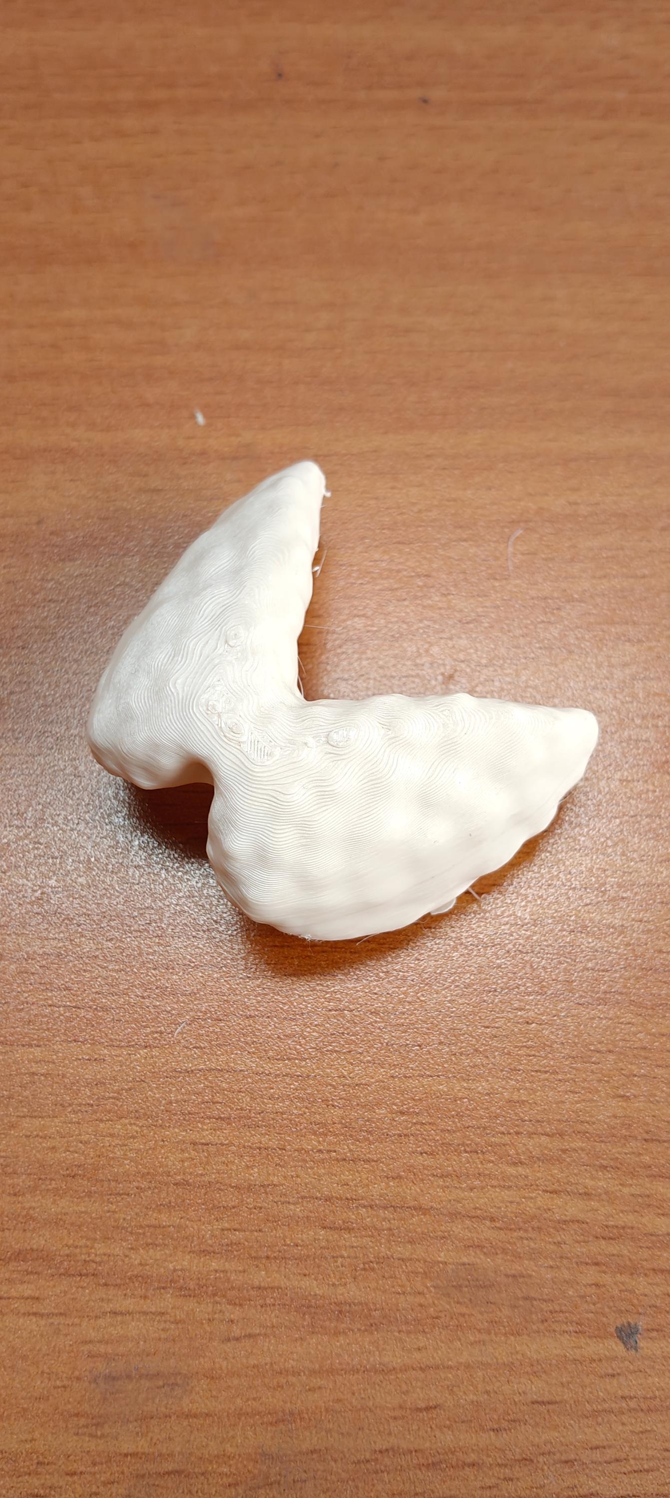 Anatomical Thyroid Gland Model | Medical Education Prop, Endocrinology Specialist Display (175mm/245mm)