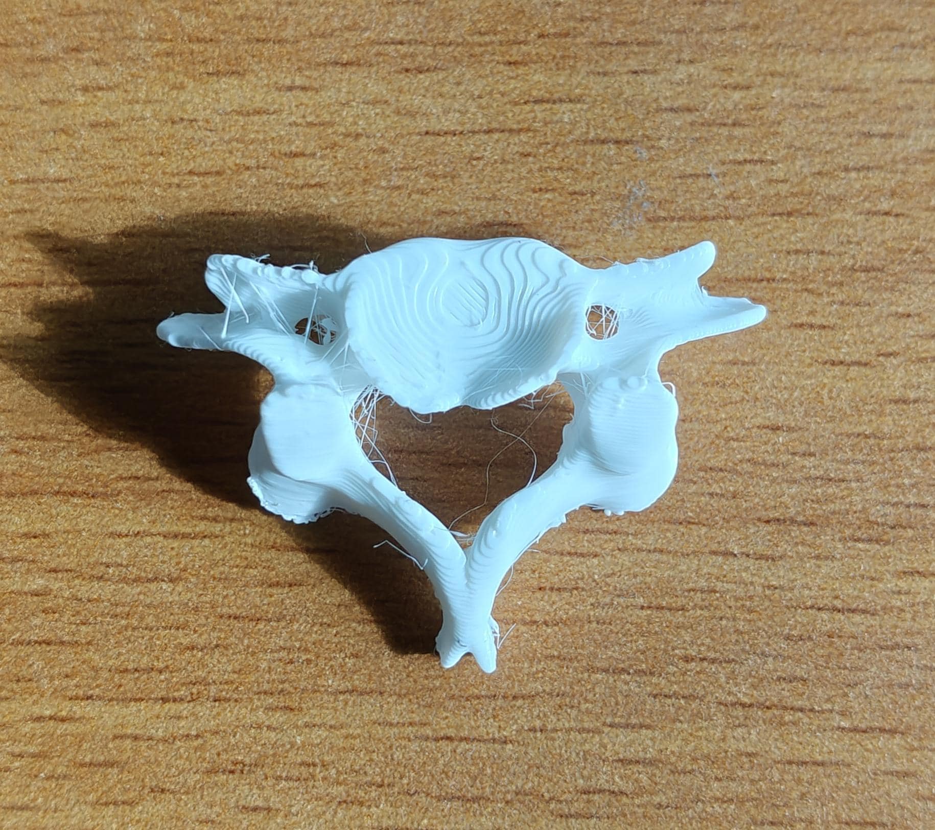 Human Vertebrae Individual Models - Atlas, Axis, Cervical, Thoracic, Lumbar Spine Osteology