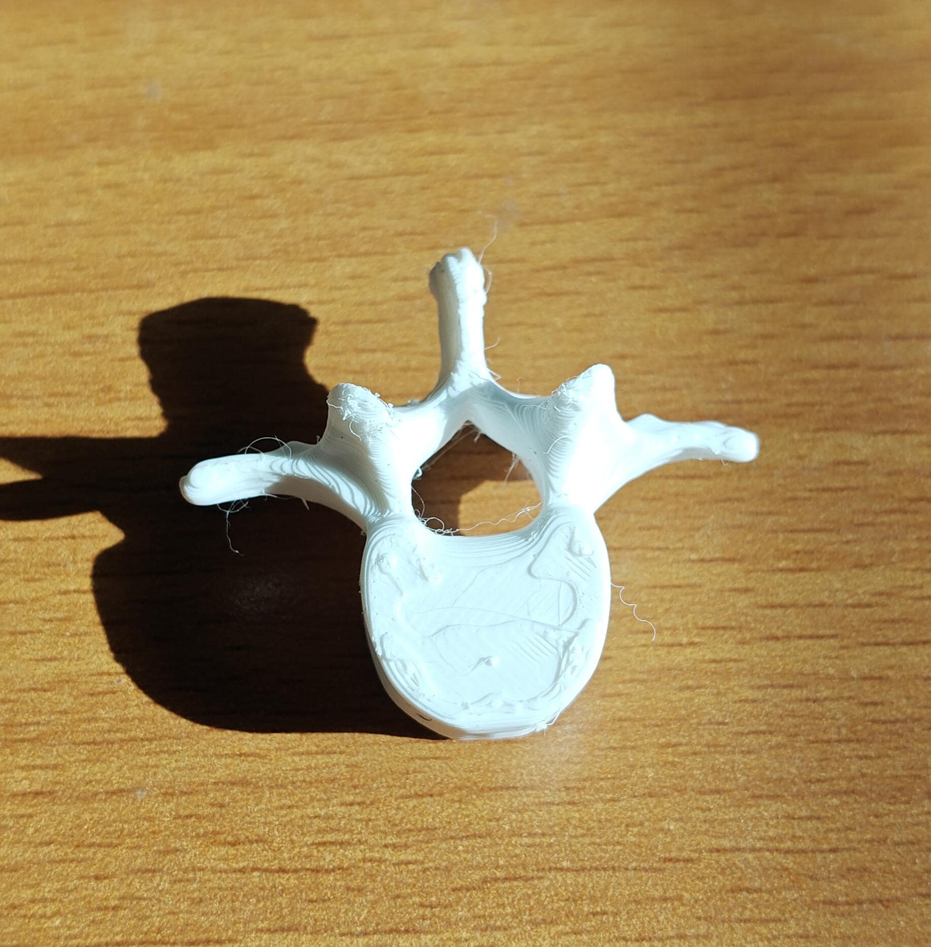 Human Vertebrae Models Set | Atlas, Axis, Cervical, Thoracic, Lumbar Osteology (170mm or 240mm)