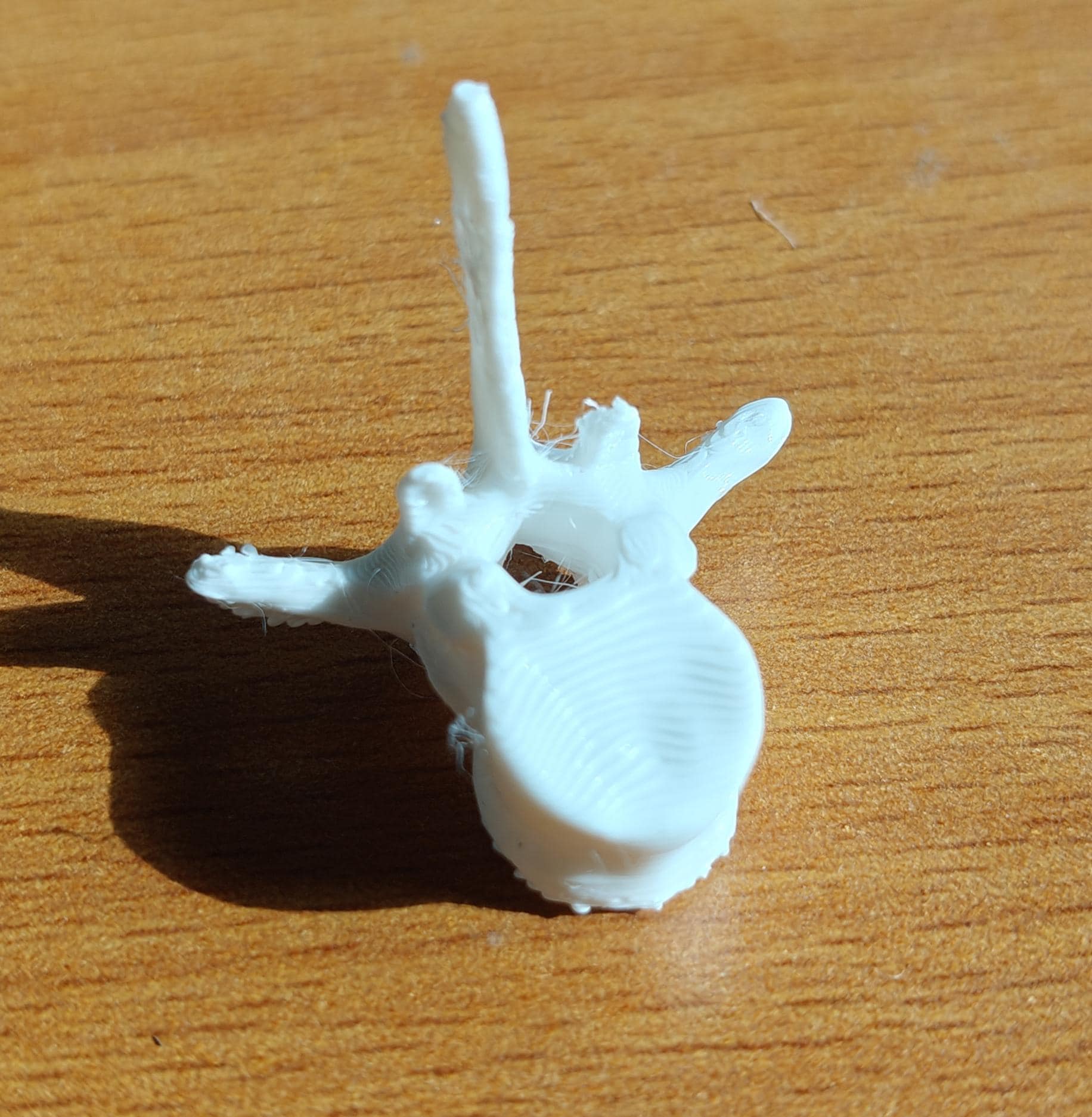 Human Vertebrae Models Set | Atlas, Axis, Cervical, Thoracic, Lumbar Osteology (170mm or 240mm)