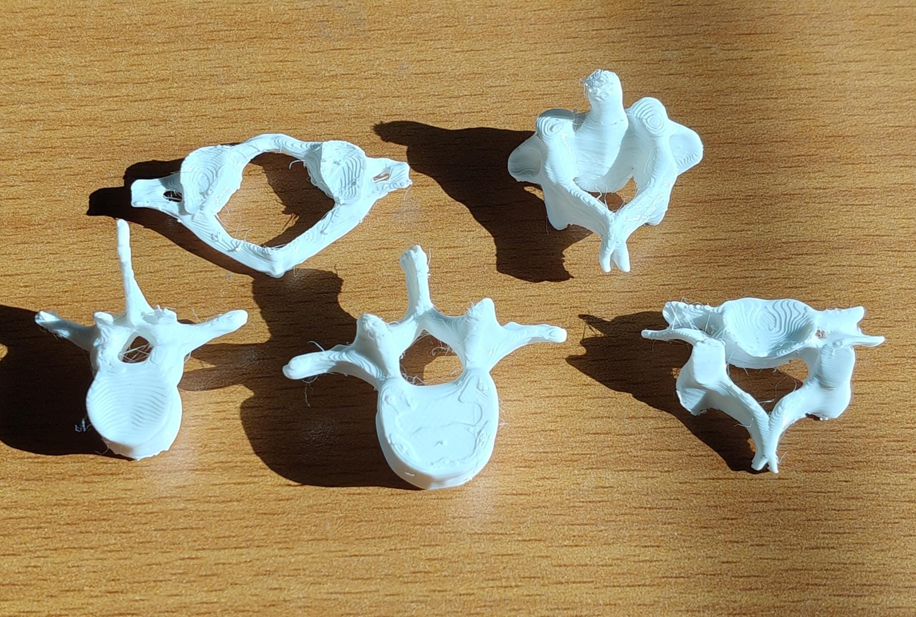 Human Vertebrae Models Set | Atlas, Axis, Cervical, Thoracic, Lumbar Osteology (170mm or 240mm)