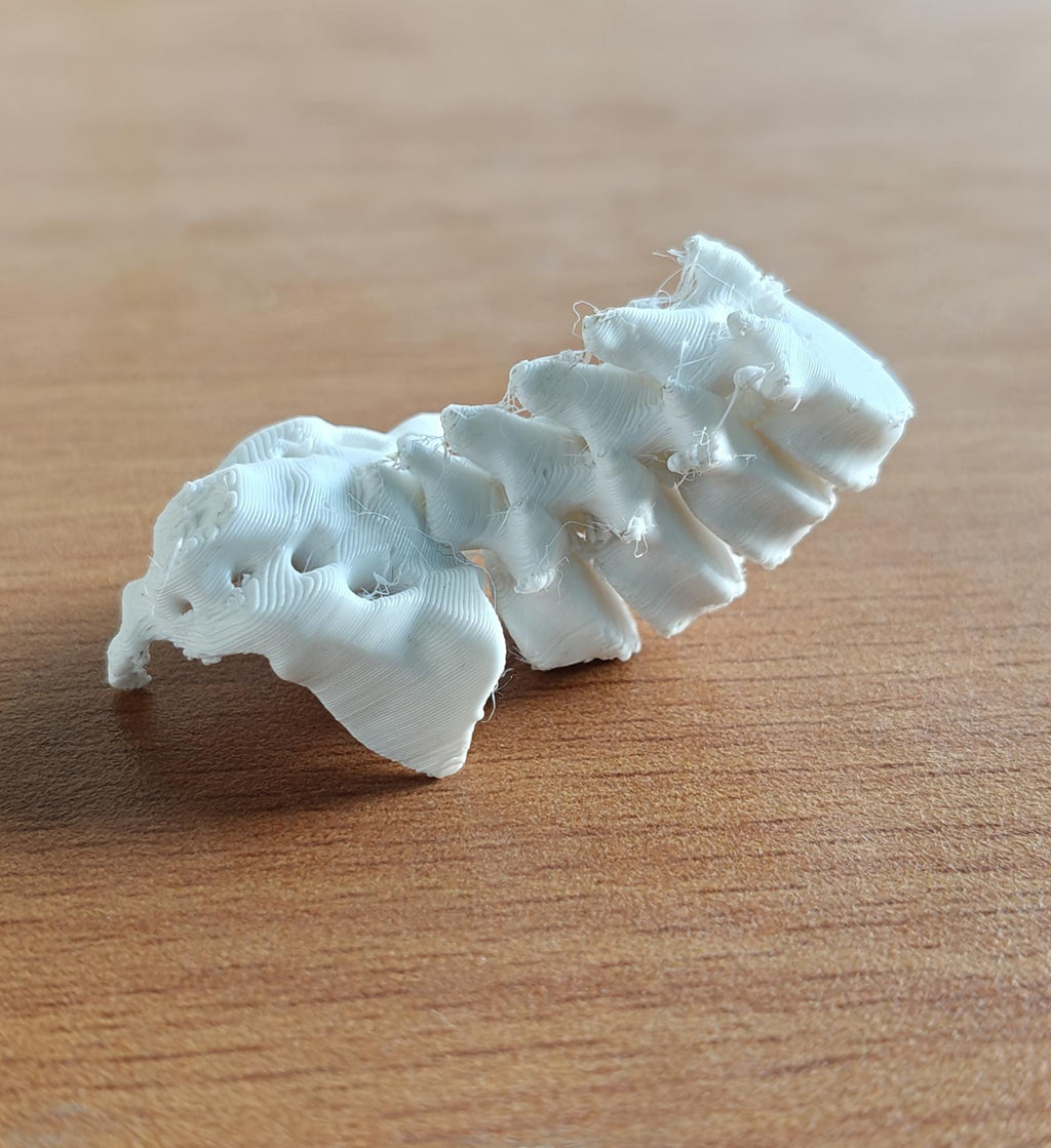 Anatomical Lumbar Spine Model L1-L5 Vertebrae with Sacrum | Medical Education Prop (170mm or 240mm)