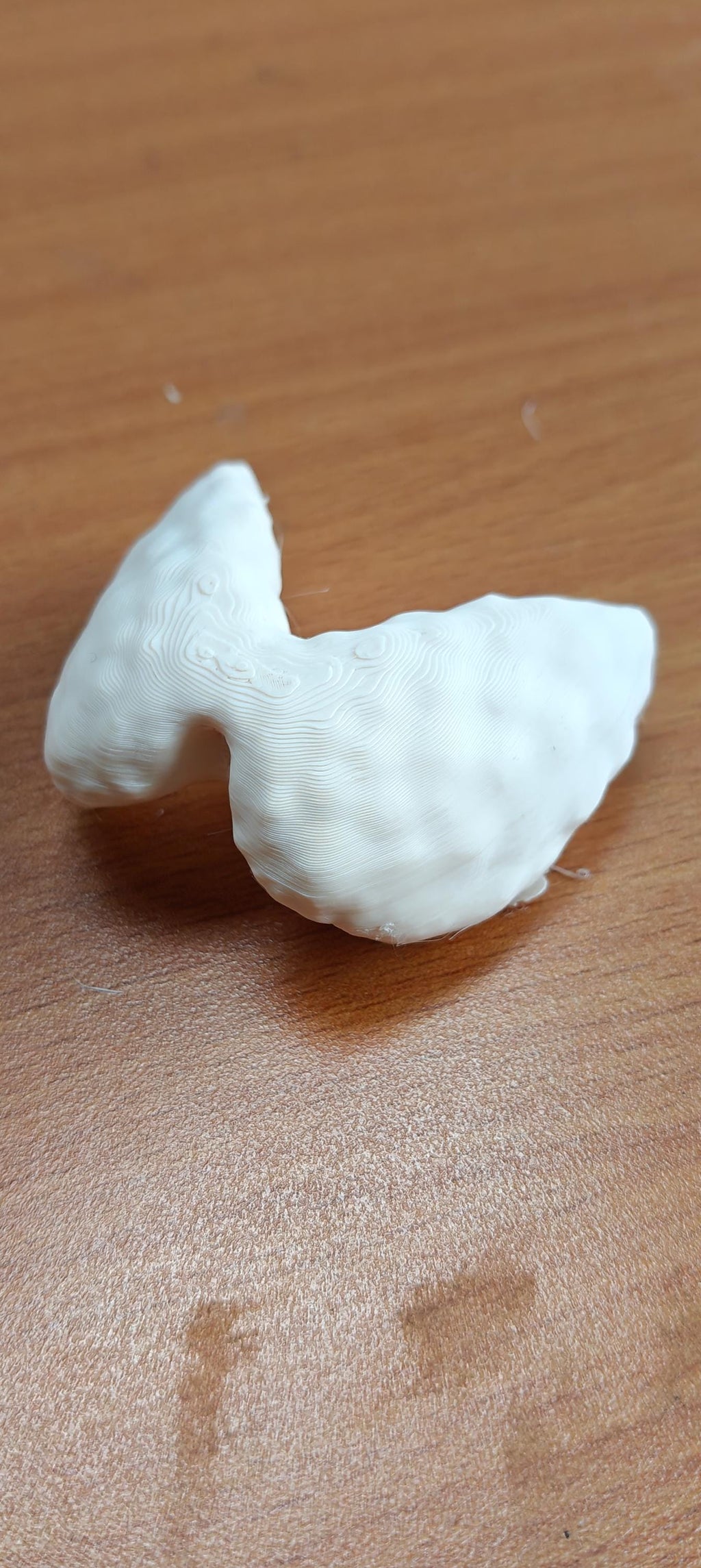 Anatomical Thyroid Gland Model | Medical Education Prop, Endocrinology Specialist Display (175mm/245mm)