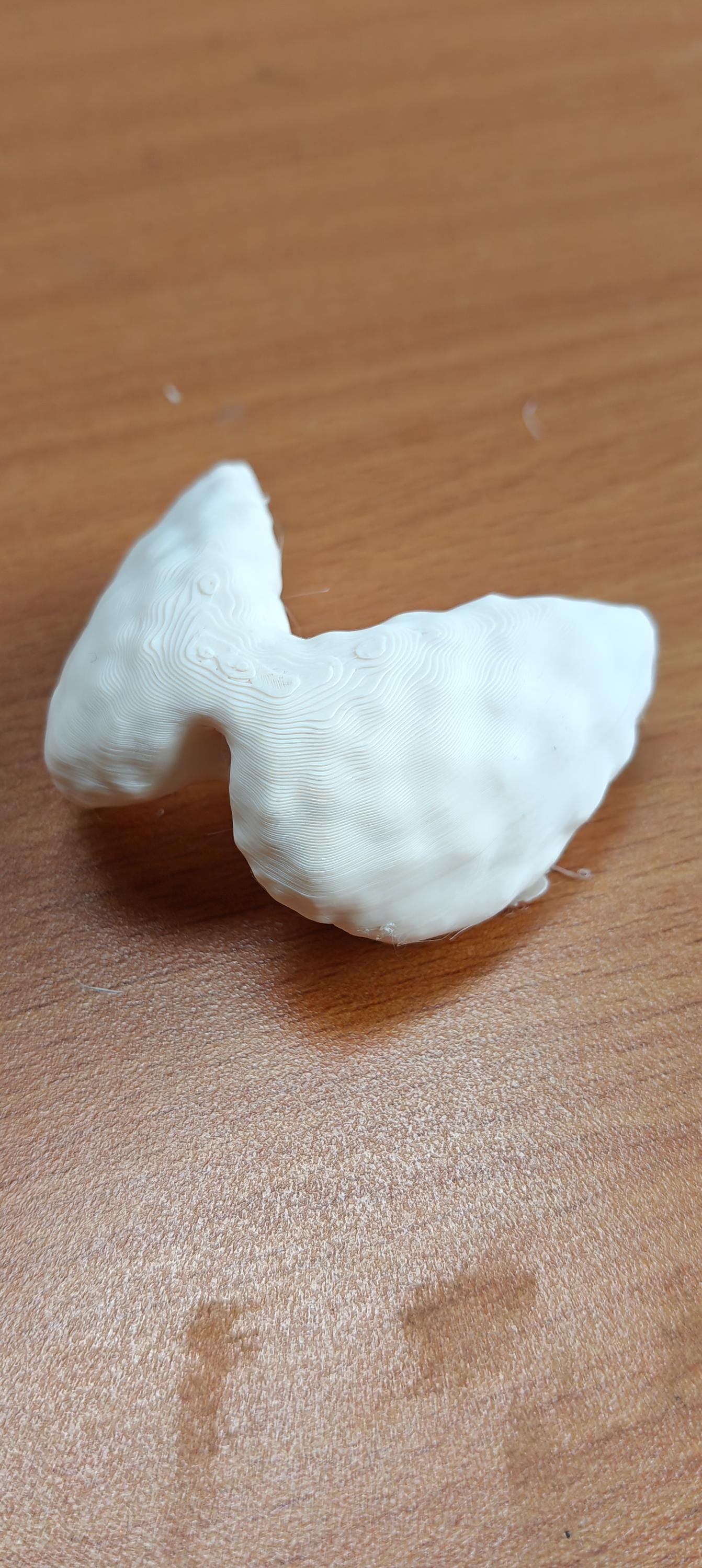 Anatomical Thyroid Gland Model | Medical Education Prop, Endocrinology Specialist Display (175mm/245mm)