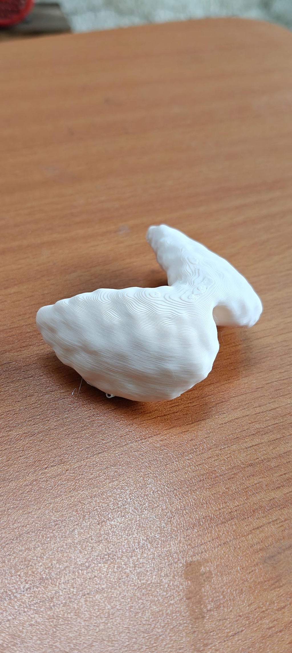 Anatomical Thyroid Gland Model | Medical Education Prop, Endocrinology Specialist Display (175mm/245mm)