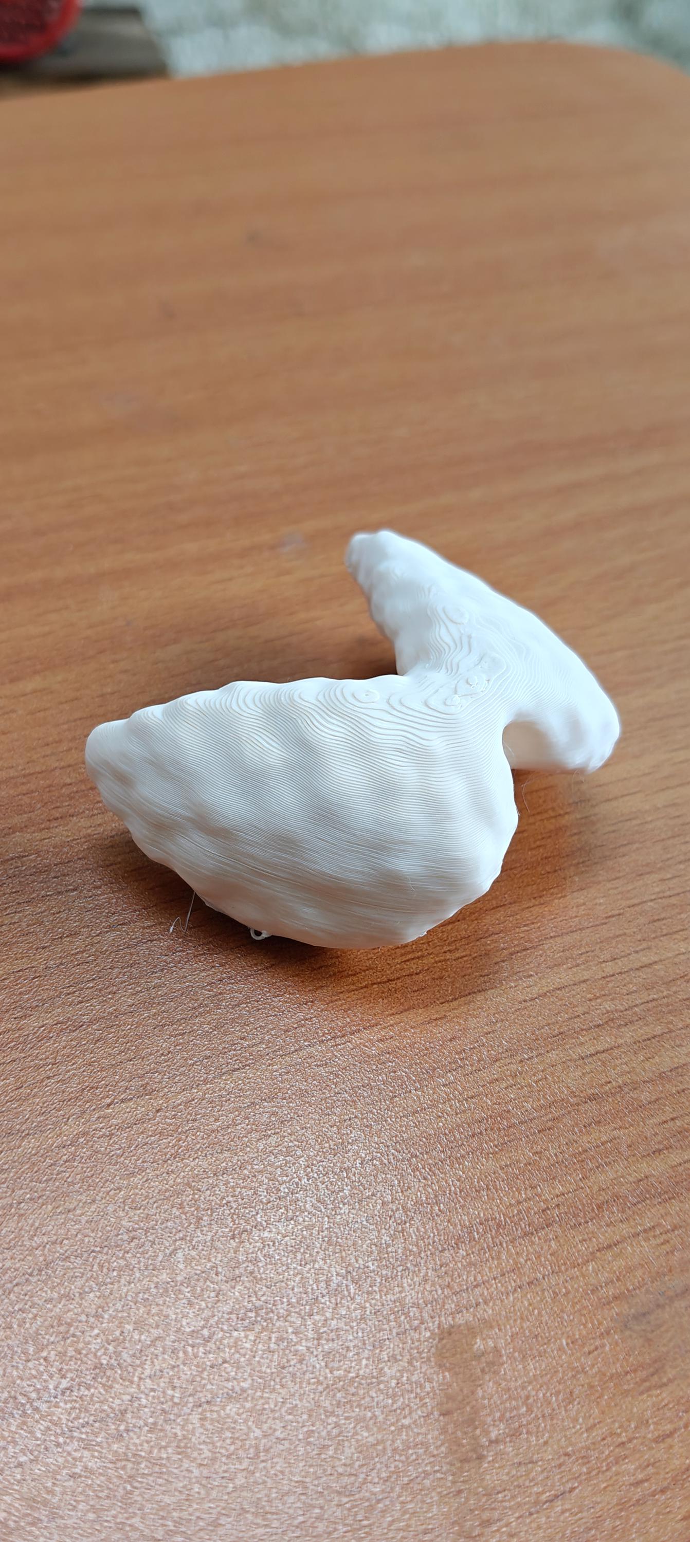 Anatomical Thyroid Gland Model | Medical Education Prop, Endocrinology Specialist Display (175mm/245mm)