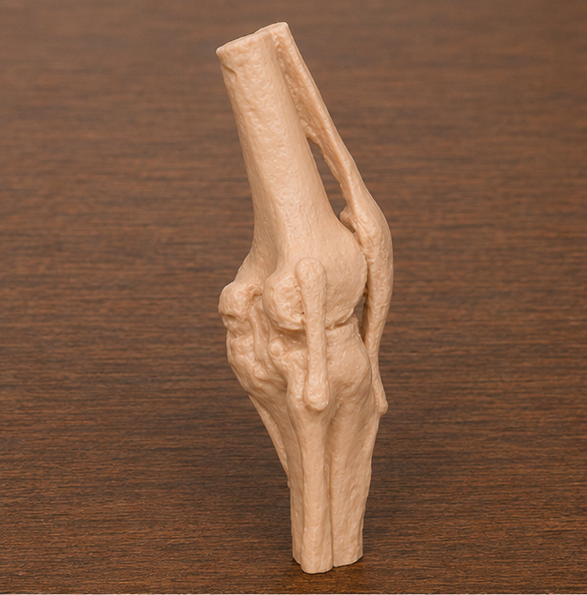Anatomical Human Knee Joint Model | Rigid Femur, Tibia and Patella Replica | Orthopedic Clinic & Sports Medicine Display | 175mm or 245mm