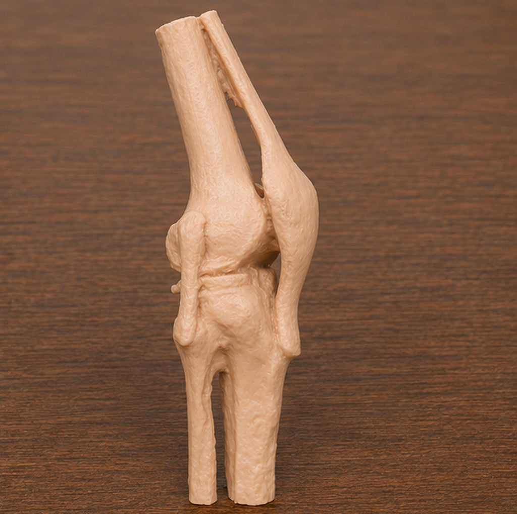 Anatomical Human Knee Joint Model | Rigid Femur, Tibia and Patella Replica | Orthopedic Clinic & Sports Medicine Display | 175mm or 245mm
