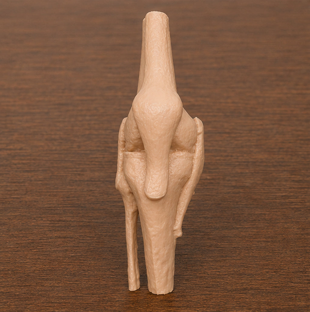 Anatomical Human Knee Joint Model | Rigid Femur, Tibia and Patella Replica | Orthopedic Clinic & Sports Medicine Display | 175mm or 245mm