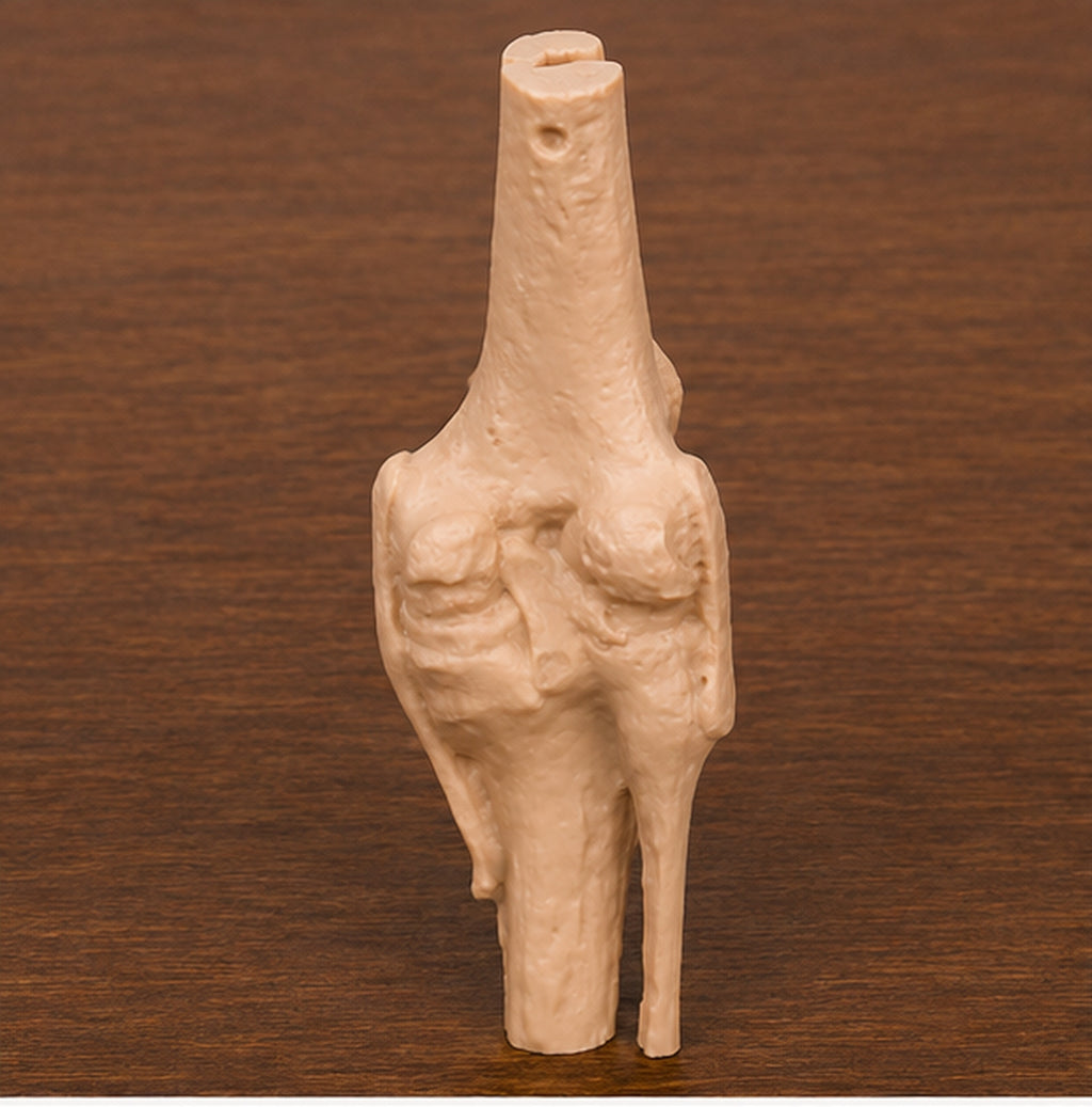 Anatomical Human Knee Joint Model | Rigid Femur, Tibia and Patella Replica | Orthopedic Clinic & Sports Medicine Display | 175mm or 245mm