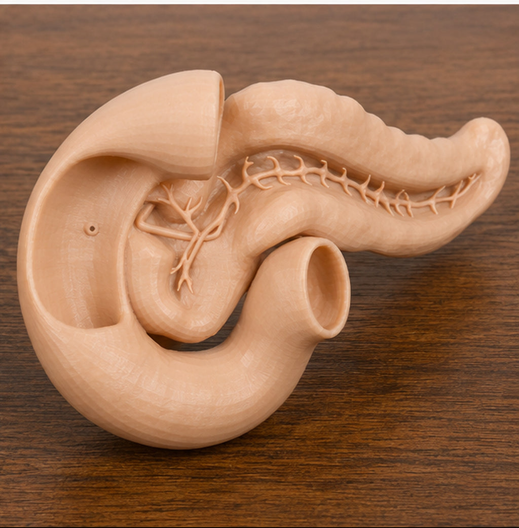 Anatomical Human Pancreas Model | Endocrine and Digestive Gland | Gastroenterology & Endocrinology Consultation Tool | 175mm or 245mm
