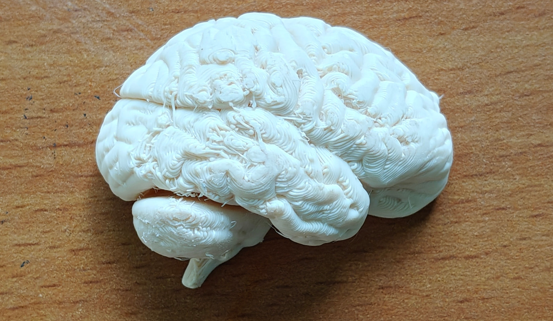 Anatomical Human Brain Cross-Section Model | Coronal and Sagittal Brain Anatomy | Neurology Classroom Display & Neurosurgeon Office Gift