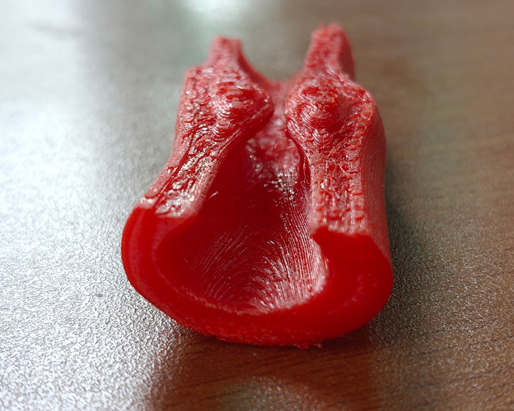 Anatomical Clotted Artery Pathological Model | Atherosclerosis Demonstration | Vascular Surgery & Cardiology Patient Prop | 175mm or 245mm