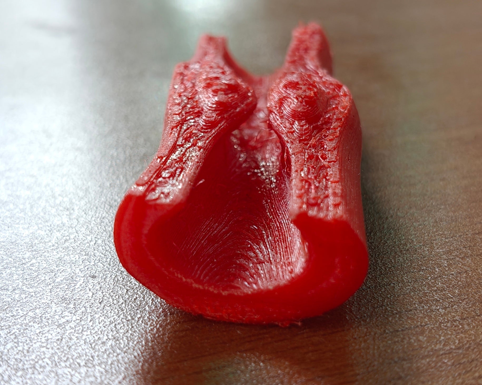 Anatomical Clotted Artery Pathological Model | Atherosclerosis Demonstration | Vascular Surgery & Cardiology Patient Prop | 175mm or 245mm