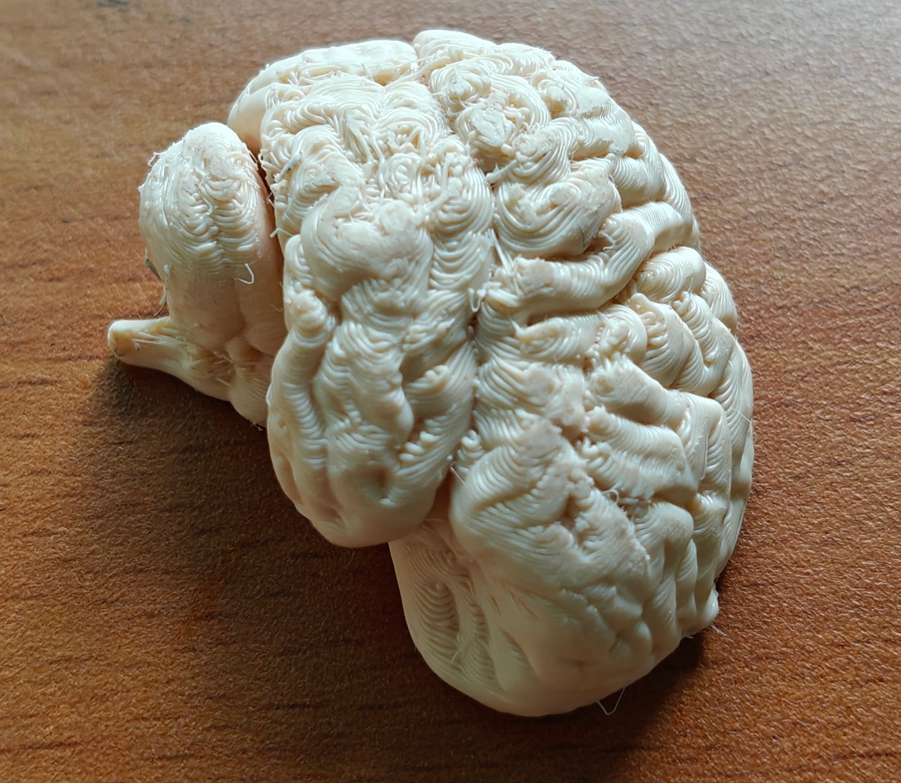 Anatomical Human Brain Cross-Section Model | Coronal and Sagittal Brain Anatomy | Neurology Classroom Display & Neurosurgeon Office Gift