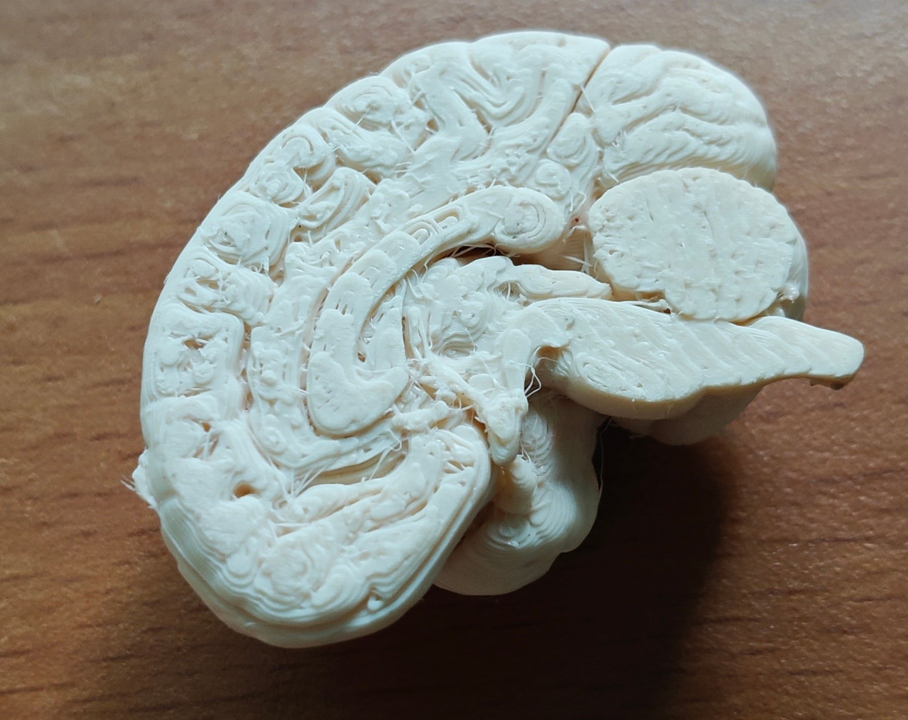 Anatomical Human Brain Cross-Section Model | Coronal and Sagittal Brain Anatomy | Neurology Classroom Display & Neurosurgeon Office Gift