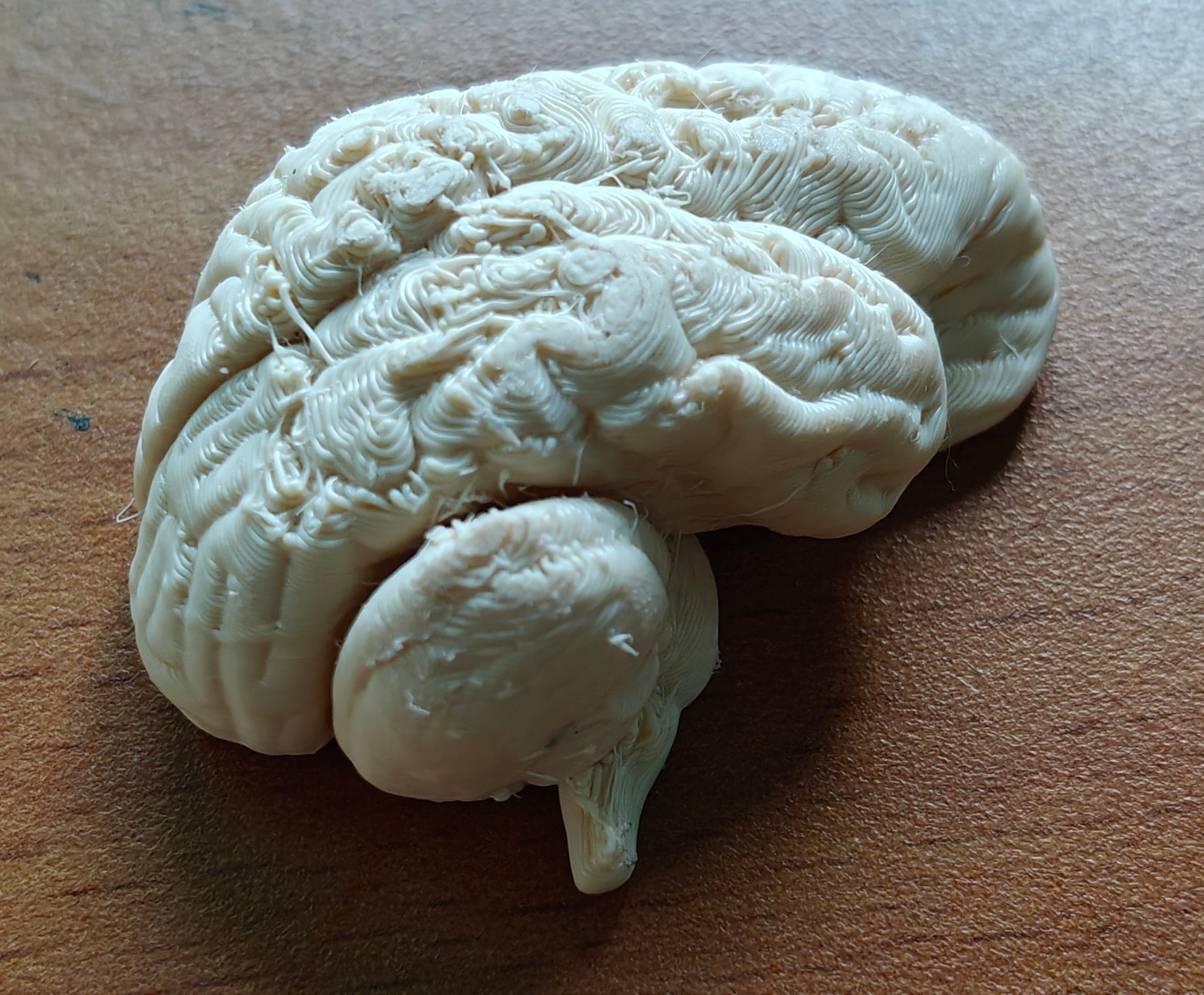 Anatomical Human Brain Cross-Section Model | Coronal and Sagittal Brain Anatomy | Neurology Classroom Display & Neurosurgeon Office Gift