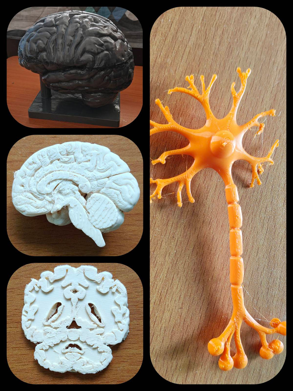 The Neurology Kit - Complete Brain Part | Brain, Neuron, Coronal and Sagittal Section | Neurologist, Neurosurgeon & Psychology Lab Display | 175mm or 245mm
